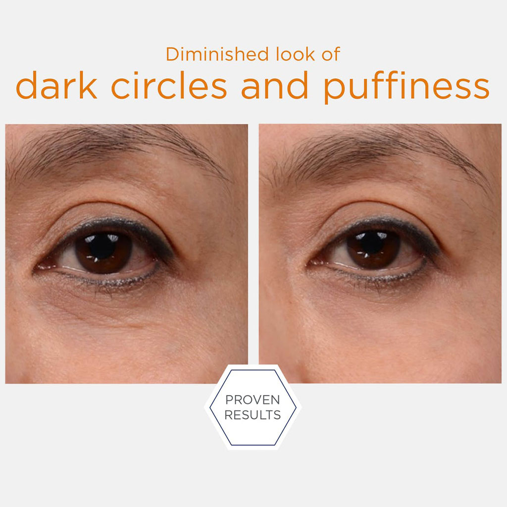 Neostrata Enlighten Brightening Eye Cream For Dark Circles, Wrinkles and Puffiness 15g