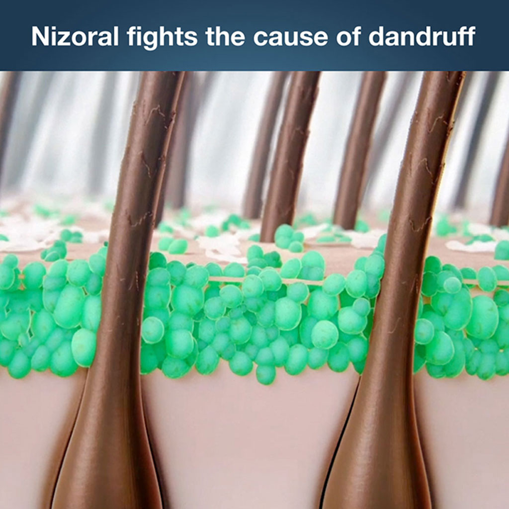 Nizoral 2% Anti Dandruff Shampoo 100ml