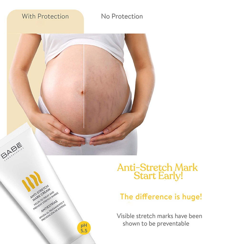Babe Anti-Stretch Marks Cream 200ml